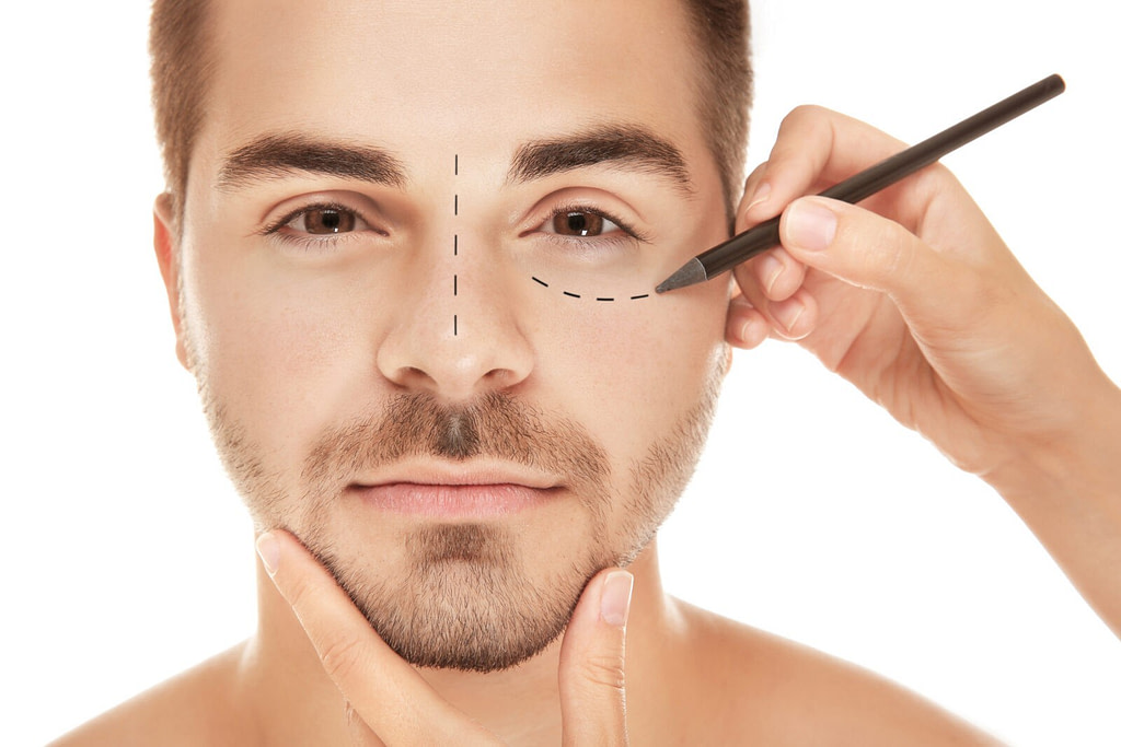 Mity o medycynie estetycznej bigstock Surgeon drawing marks on male 169631999
